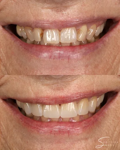 Peninsula Center of Cosmetic Dentistry Mountain View