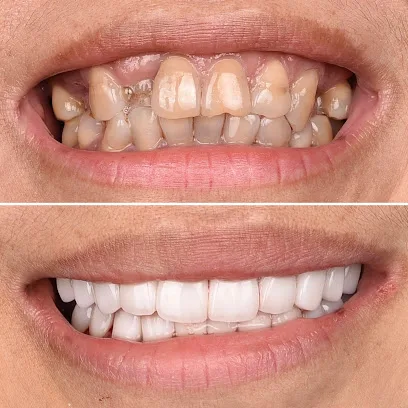 Pierce Aesthetics Dental Group of Orange County
