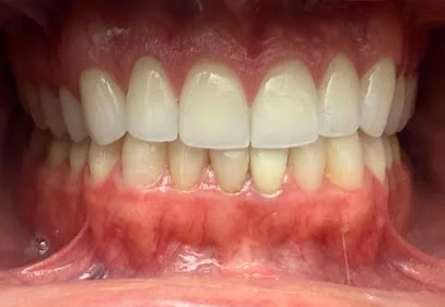 Playa Vista Dental Care