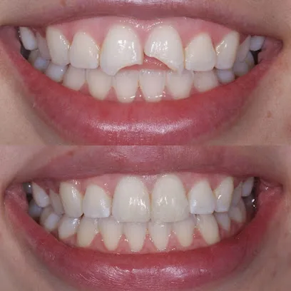 Premier Dental Esthetics | Dentist Arcadia