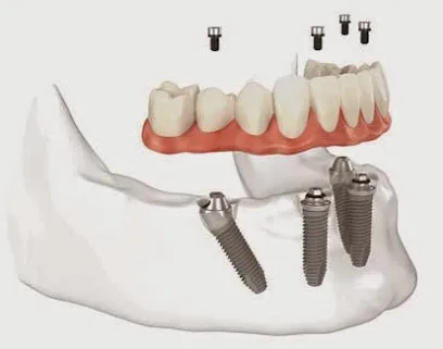Queen Creek Complete Dental