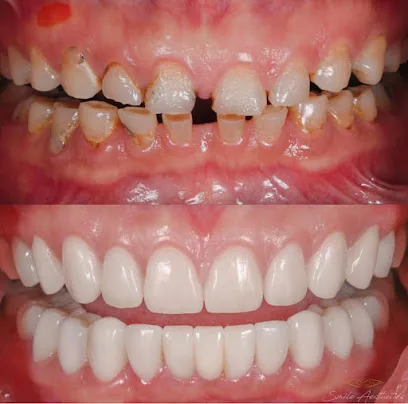 Riviera Smiles - Santa Barbara Dentist - Dr. Ana Martinez