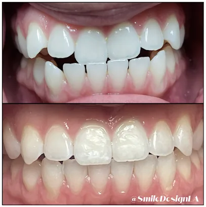 Smile Design Dental