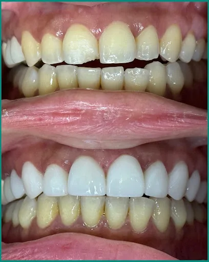 Smile Design NJ