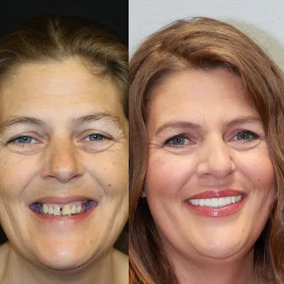 SmileOnImplants