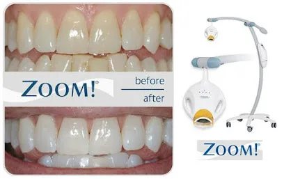 Sunnyvale Dental Aesthetics