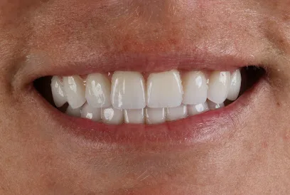 The Hills Dental Spa