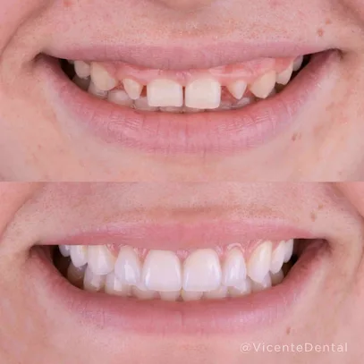 Vicente Dental