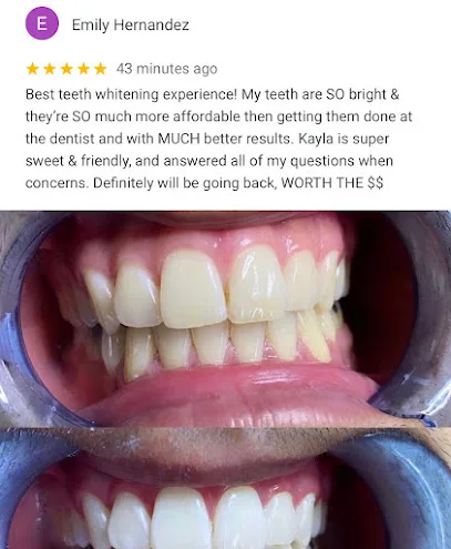 Vivid Smile Studio Teeth Whitening
