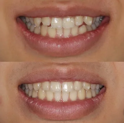 West Covina Perfect Smile Dentistry
