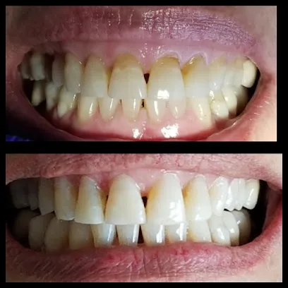 Your La Puente Family Dentistry