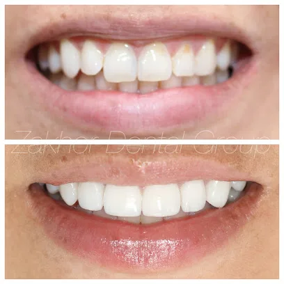 Zakhor Dental Group- Beverly Hills cosmetic dentist